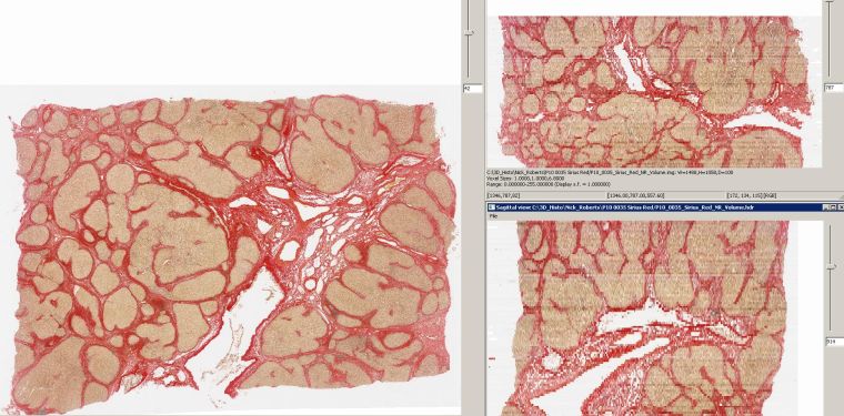 Picro-Sirius red stain